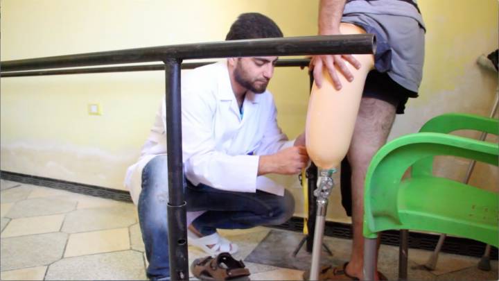 المشروع الوطني السوري للأطراف الصناعية 